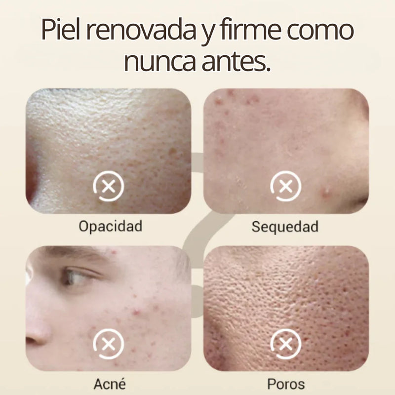 Hidratación, Claridad y Renovación con ClariSkin 50ml – Tu Piel Más Joven y Uniforme. [Uso nocturno]