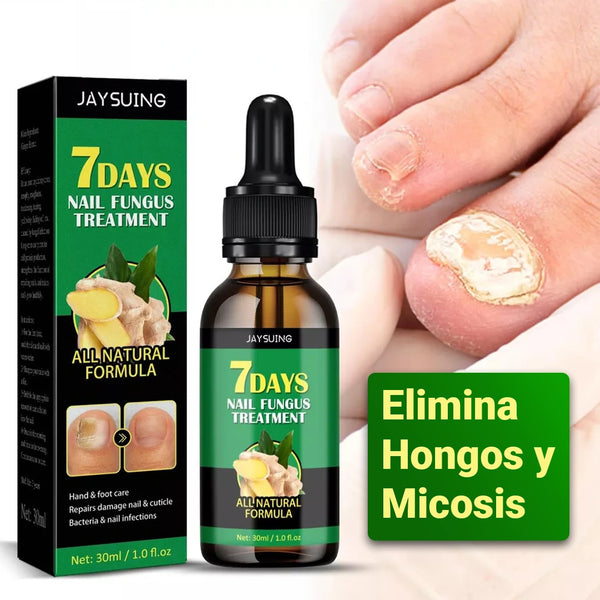 Aceite de Jengibre Antimicótico para Uñas - RenovaUñas [PAGO SOLO AL RECIBIR]